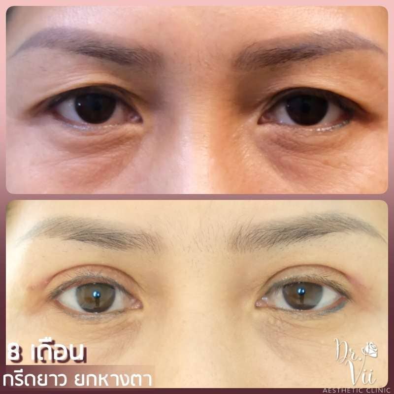 Dr.Vii Clinic