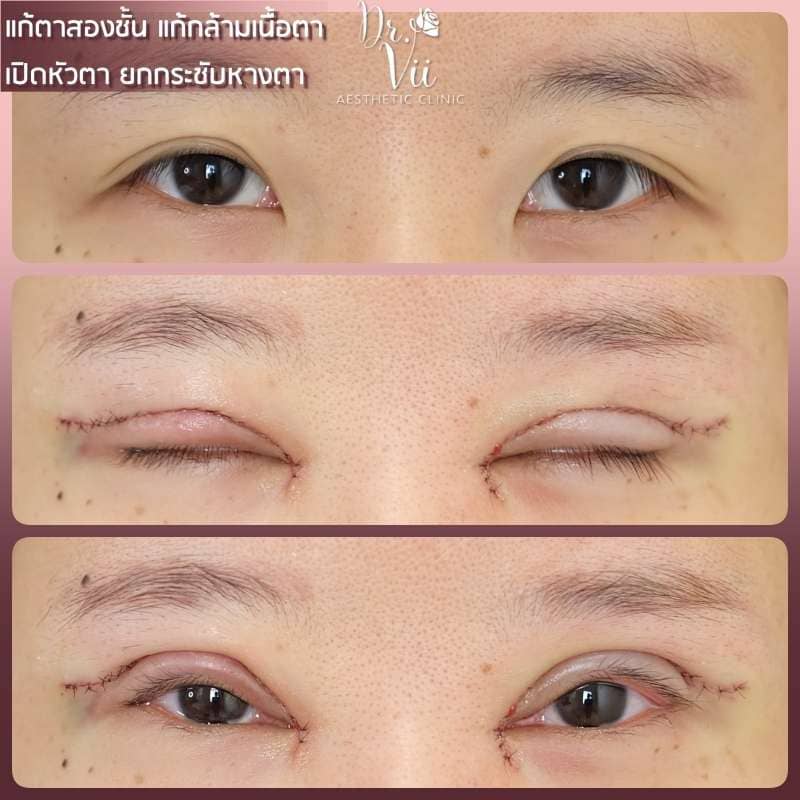 Dr.Vii Clinic